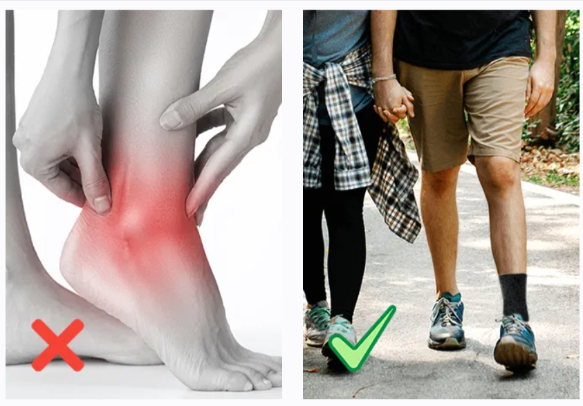 Comprex Ankle Sleeves Features