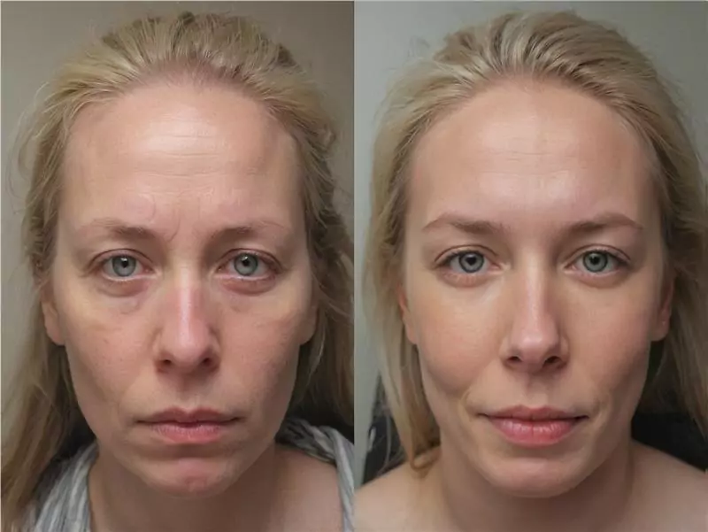 DeepSleep Bliss Customer REVIEWS