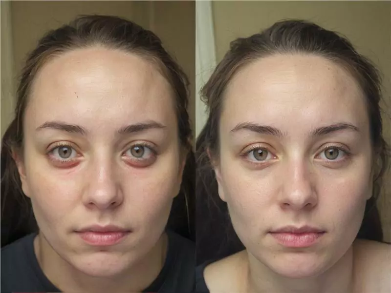 DeepSleep Bliss Customer