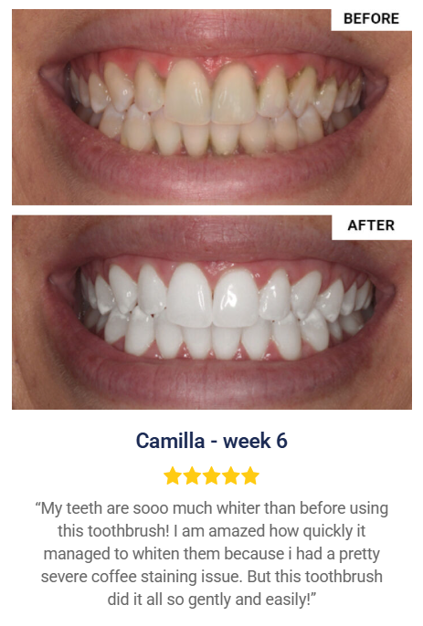 Effortlessly-White-Smile-With-WellaWhite-Electric-Toothbrush-
