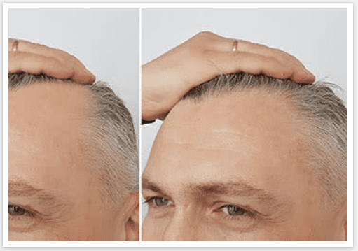 Rescue-Hair-911-Customer-Reviews