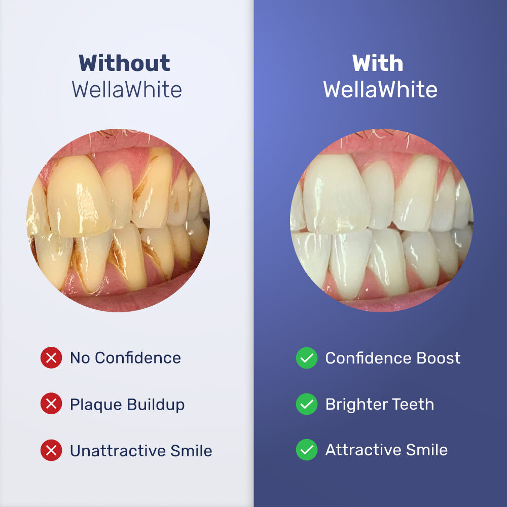 Wellawhite Electric Toothbrush Benefits
