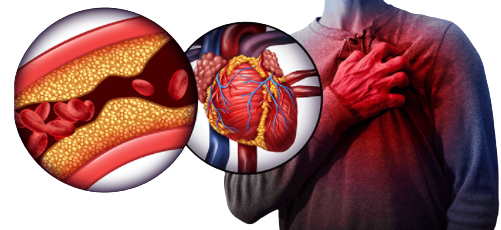 Advanced BioNutritionals Circutol Blood Pressure Support Formula