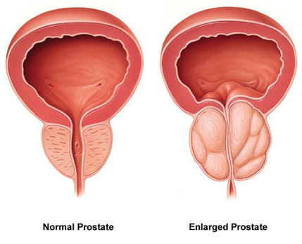 Prostate 911 Ingredients