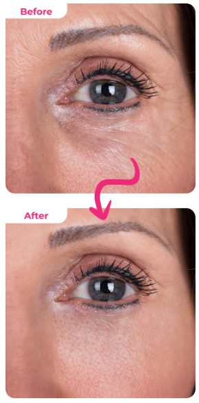 CollaGlow Before & After Results