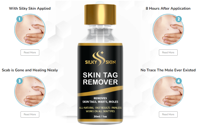 Silky Skin Tag Remover Benefits