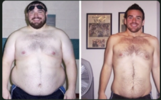 Beyond Body For Men Before & After Results | Nuvectra Medical