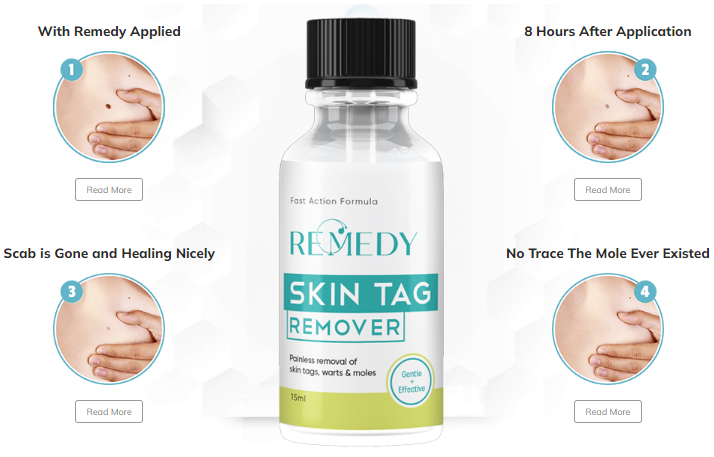 Remedy Skin Tag Remover Benefits
