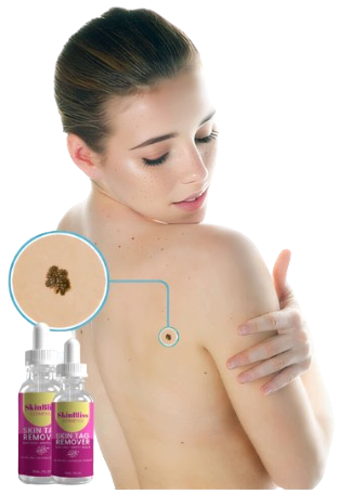 SkinBliss Skin Tag Remover Serum