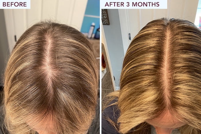 Fully Vital Enhance Hair Density Serum Benefits