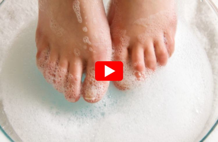 Bleach for Toenail Fungus video
