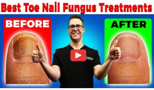 Cure for Toenail Fungus