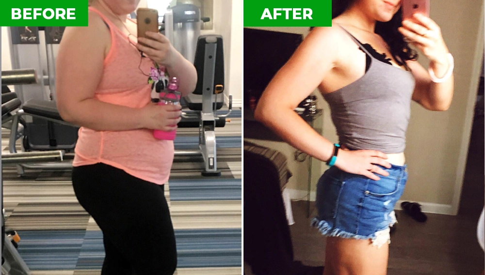 SlimBliss before and after