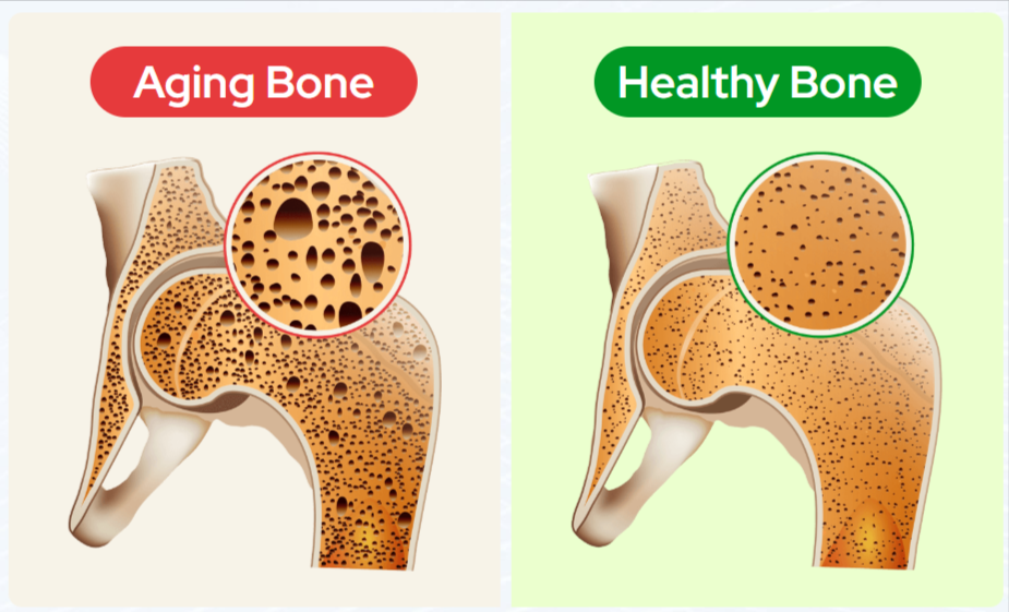 BioCal Bone Support Benefits