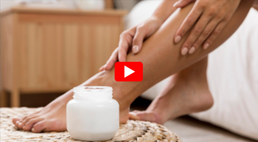 Ketoconazole Cream for Toenail Fungus video