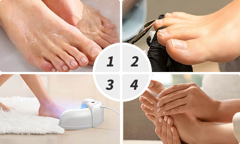 Laser Therapy for Nail Fungus steps