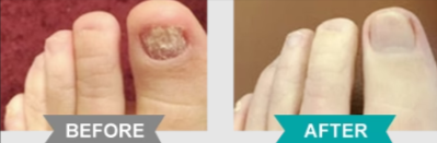 before-after-