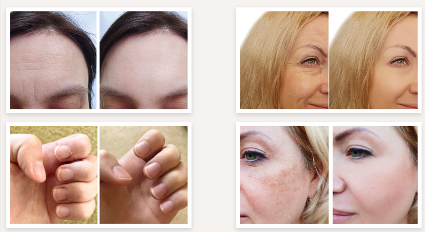 Collagen Nutra Boost Gummies