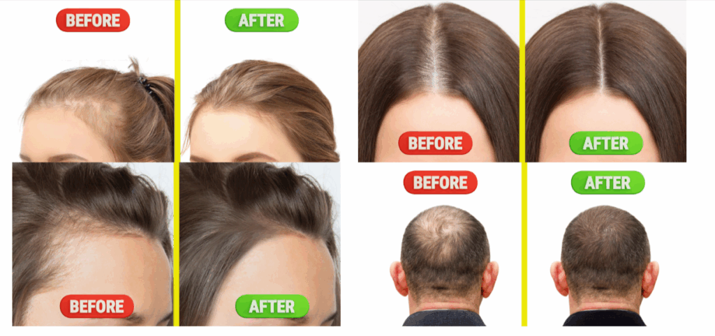 Essential Growth Hair Serum