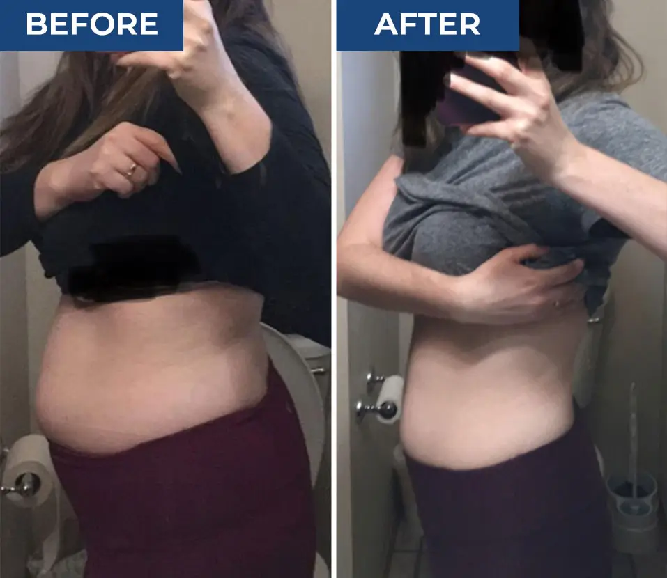PuraBurn benefits