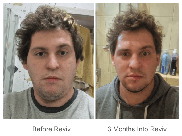 The Reviv Mouthguard