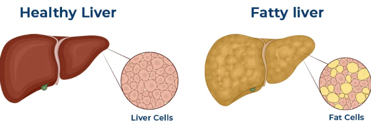 Levitox benefits