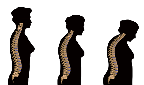 Ultimate Bone Support-Benefits