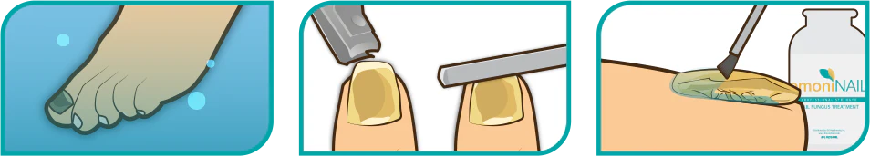 How To Use?